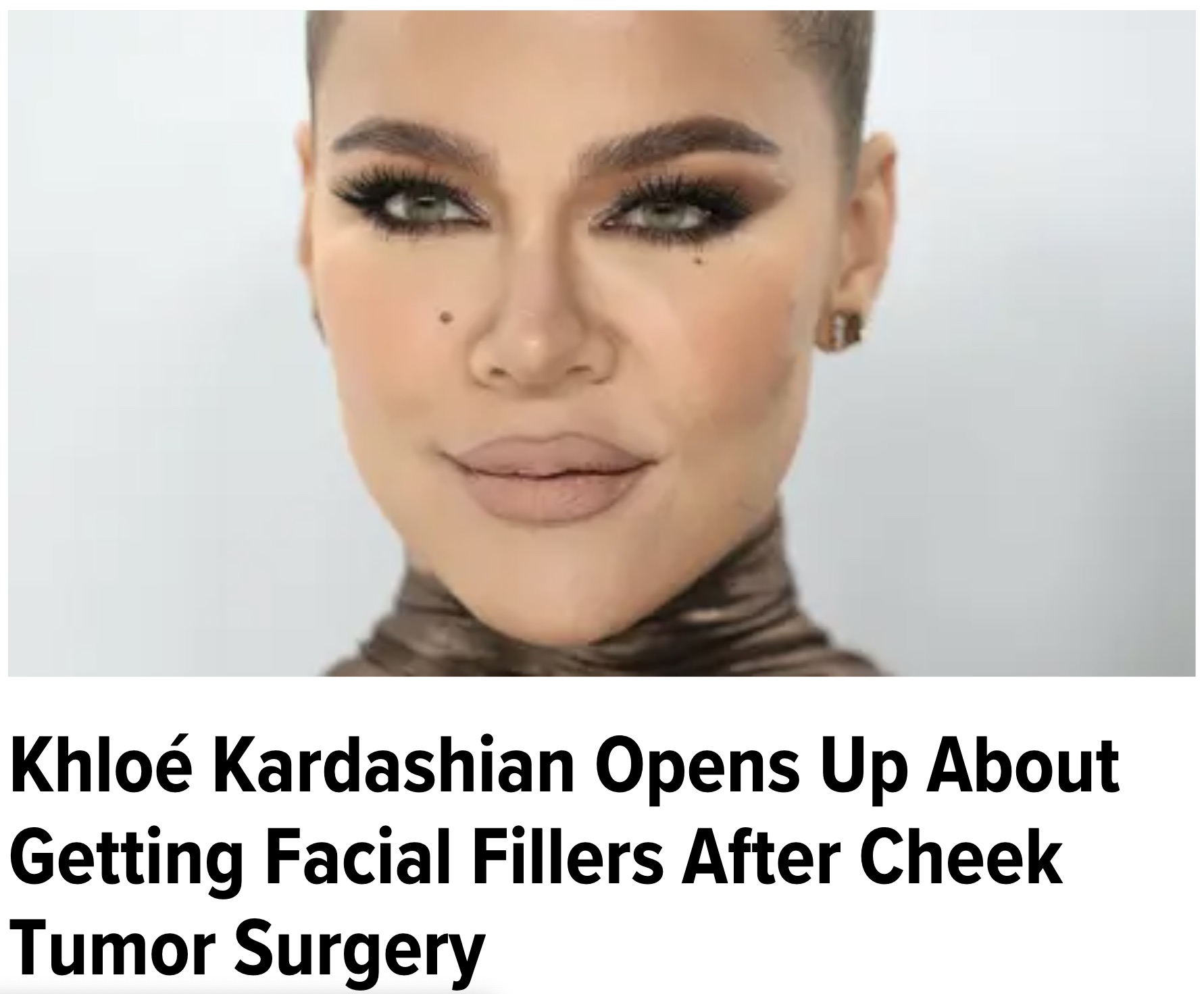 khloe kardashian tumor - Khlo Kardashian Opens Up About Getting Facial Fillers After Cheek Tumor Surgery